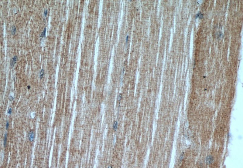 Immunohistochemical of paraffin-embedded human skeletal muscle using Catalog No:110384(EFNA3 antibody) at dilution of 1:50 (under 40x lens)
