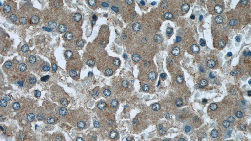 Immunohistochemical of paraffin-embedded human liver using Catalog No:115231(SIKE1 antibody) at dilution of 1:50 (under 40x lens)