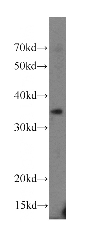 mouse brain tissue were subjected to SDS PAGE followed by western blot with Catalog No:113548(CDK5R1 antibody) at dilution of 1:600