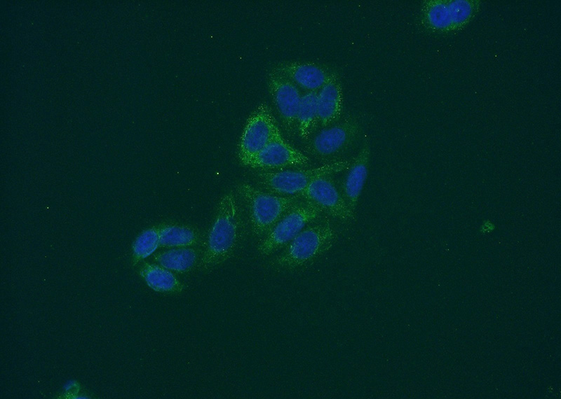 Immunofluorescent analysis of HepG2 cells using Catalog No:110547(FBXO17 Antibody) at dilution of 1:50 and Alexa Fluor 488-congugated AffiniPure Goat Anti-Rabbit IgG(H+L)