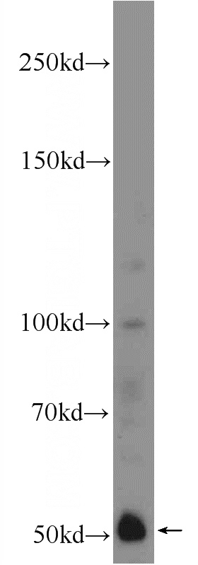 HeLa cells were subjected to SDS PAGE followed by western blot with Catalog No:111617(IFIT1 Antibody) at dilution of 1:600