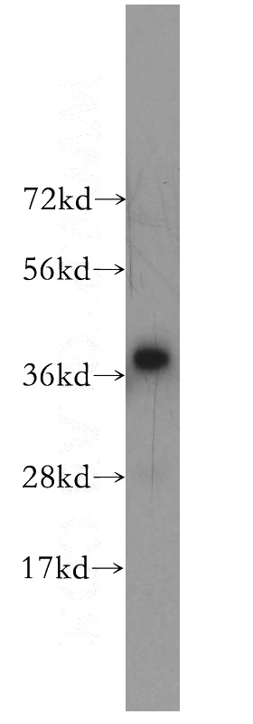 HEK-293 cells were subjected to SDS PAGE followed by western blot with Catalog No:114076(PP2A antibody) at dilution of 1:500
