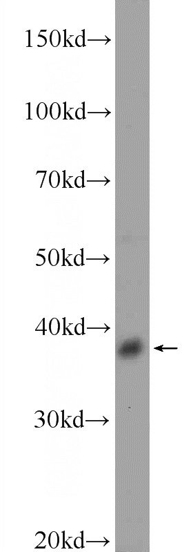 HeLa cells were subjected to SDS PAGE followed by western blot with Catalog No:110029(DSN1 Antibody) at dilution of 1:1500