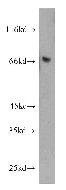 human spleen tissue were subjected to SDS PAGE followed by western blot with Catalog No:112110(KLRF1 antibody) at dilution of 1:500