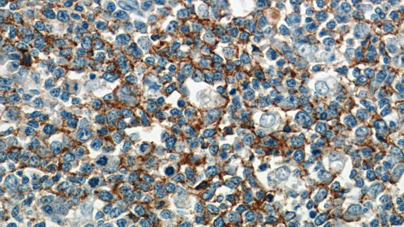 Immunohistochemistry of paraffin-embedded human tonsillitis slide using Catalog No:109032(CD37 Antibody) at dilution of 1:50