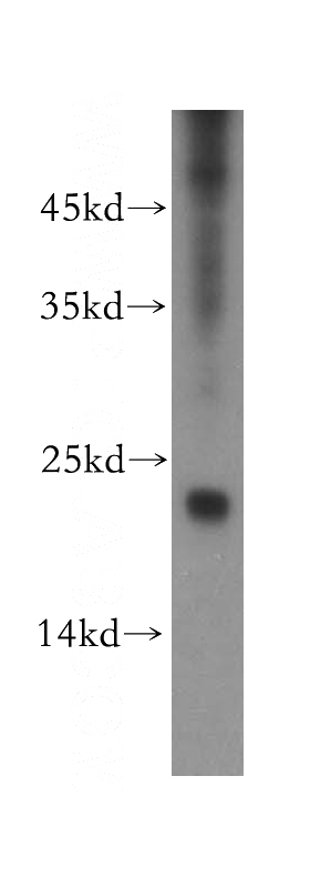 mouse spleen tissue were subjected to SDS PAGE followed by western blot with Catalog No:114738(RNF125 antibody) at dilution of 1:300
