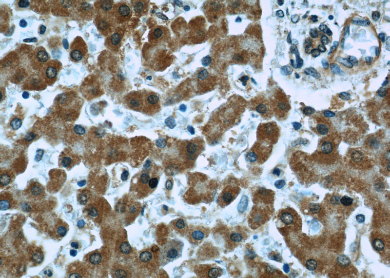 Immunohistochemistry of paraffin-embedded human liver slide using Catalog No:107196(EXOSC2 Antibody) at dilution of 1:50