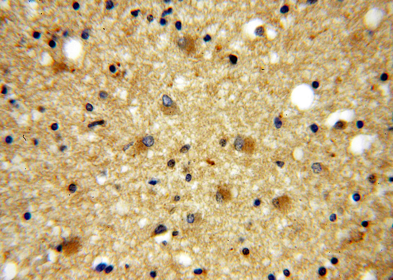 Immunohistochemical of paraffin-embedded human brain using Catalog No:111137(GPRASP1-Specific antibody) at dilution of 1:100 (under 40x lens)