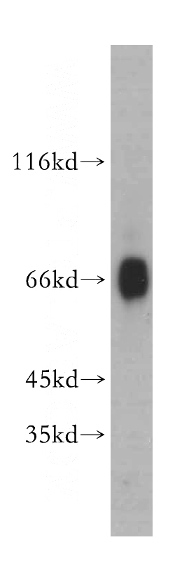 mouse testis tissue were subjected to SDS PAGE followed by western blot with Catalog No:108377(BBS9 antibody) at dilution of 1:300