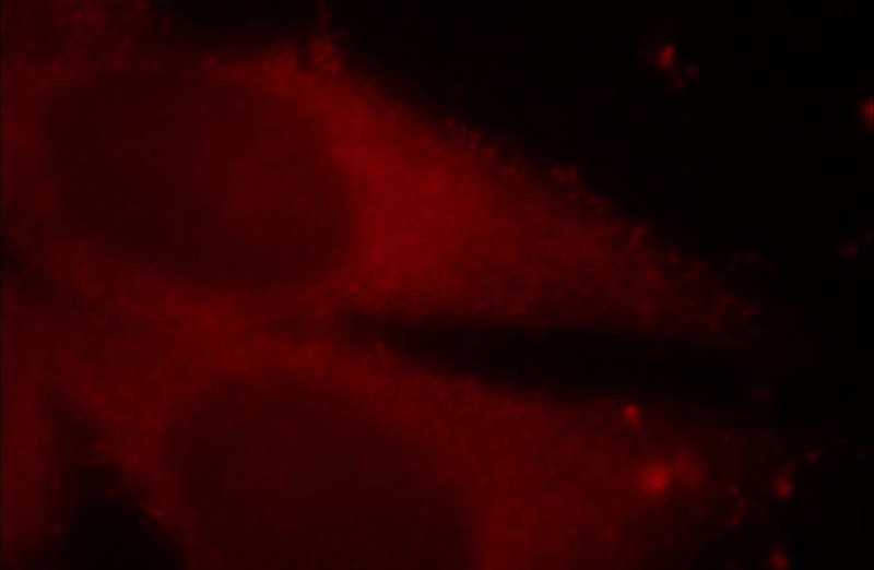 Immunofluorescent analysis of HepG2 cells, using MAT2B antibody Catalog No:112494 at 1:25 dilution and Rhodamine-labeled goat anti-rabbit IgG (red).