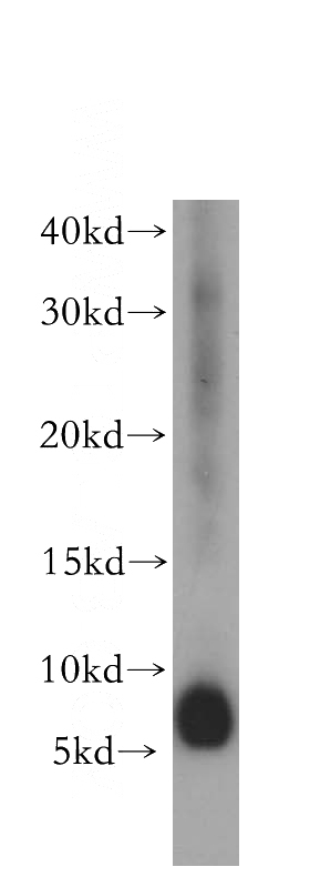 human liver tissue were subjected to SDS PAGE followed by western blot with Catalog No:116584(USMG5 antibody) at dilution of 1:400