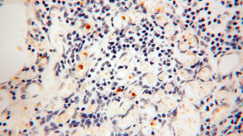 Immunohistochemical of paraffin-embedded human thymus using Catalog No:114507(RACGAP1 antibody) at dilution of 1:100 (under 40x lens)