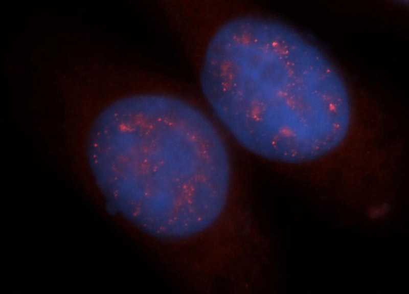 Immunofluorescent analysis of Hela cells, using Catalog No:115917 and Rhodamine-labeled goat anti-rabbit IgG (red). Blue pseudocolor = DAPI (fluorescent DNA dye).