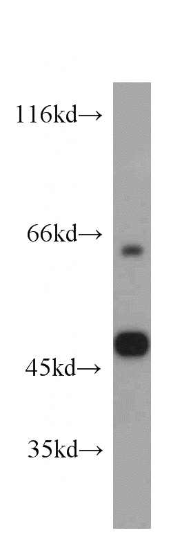 mouse brain tissue were subjected to SDS PAGE followed by western blot with Catalog No:114198(PRKAR2B antibody) at dilution of 1:300