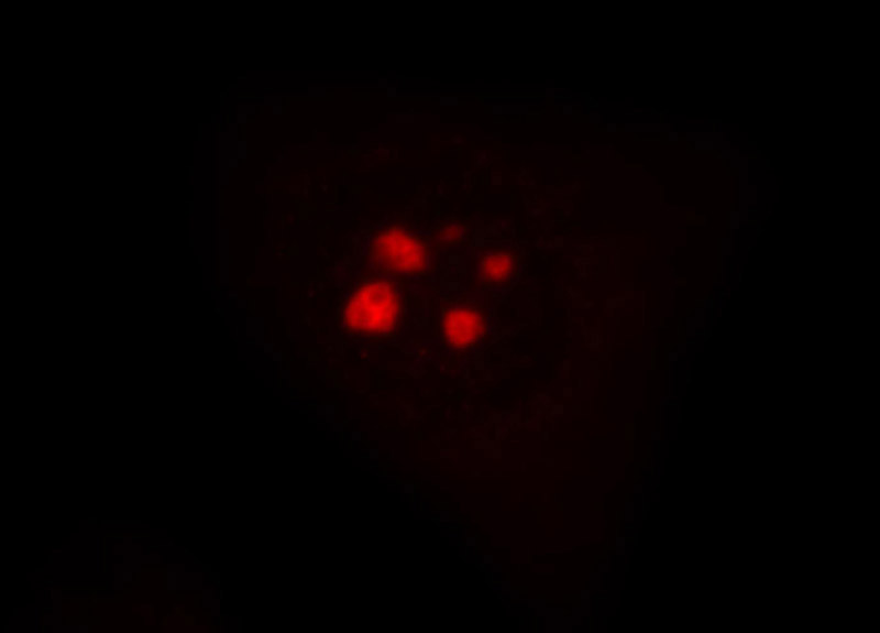 Immunofluorescent analysis of Hela cells, using UTP20 antibody Catalog No:110022 at 1:50 dilution and Rhodamine-labeled goat anti-rabbit IgG (red).