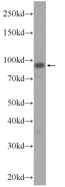 HEK-293 cells were subjected to SDS PAGE followed by western blot with Catalog No:117029(ZNF746 Antibody) at dilution of 1:1000