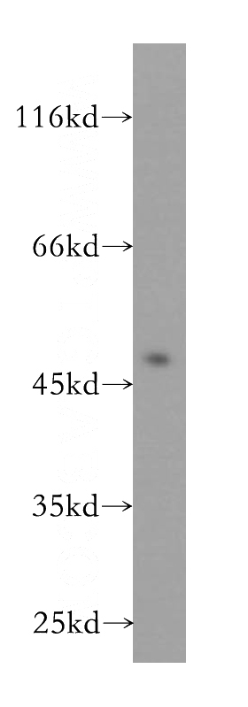 Jurkat cells were subjected to SDS PAGE followed by western blot with Catalog No:116857(WDR18 antibody) at dilution of 1:500