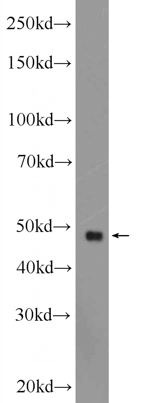 mouse heart tissue were subjected to SDS PAGE followed by western blot with Catalog No:111124(GPR22 Antibody) at dilution of 1:600