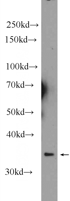 mouse heart tissue were subjected to SDS PAGE followed by western blot with Catalog No:113792(PGP Antibody) at dilution of 1:1000