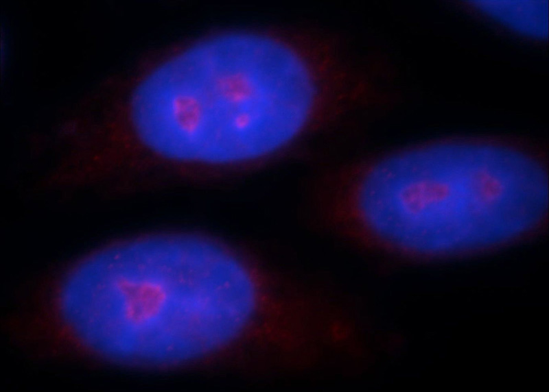 Immunofluorescent analysis of HepG2 cells, using ZNF74 antibody Catalog No:117027 at 1:25 dilution and Rhodamine-labeled goat anti-rabbit IgG (red). Blue pseudocolor = DAPI (fluorescent DNA dye).
