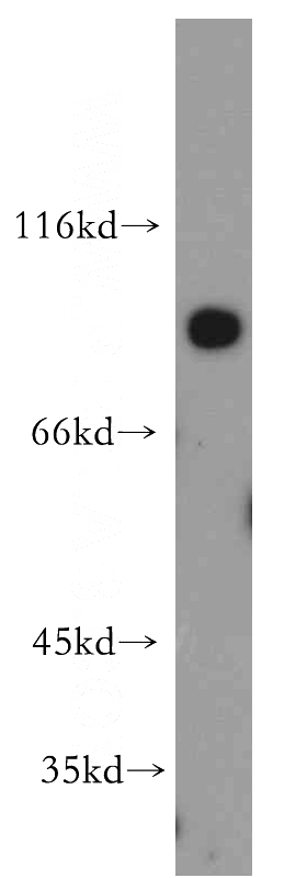 DU 145 cells were subjected to SDS PAGE followed by western blot with Catalog No:114005(PLOD2 antibody) at dilution of 1:300