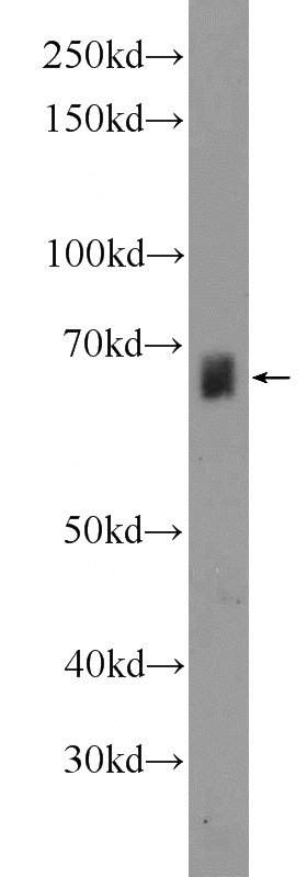 mouse liver tissue were subjected to SDS PAGE followed by western blot with Catalog No:117155(ZNF284 Antibody) at dilution of 1:300