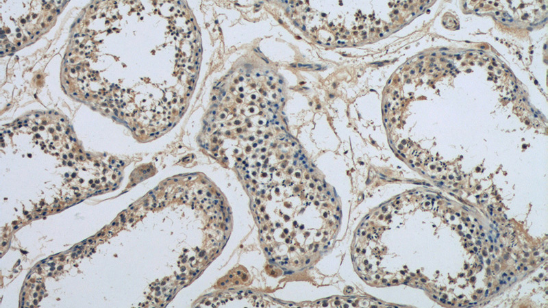 Immunohistochemistry of paraffin-embedded human testis tissue slide using Catalog No:115554(SPATA6 Antibody) at dilution of 1:50 (under 10x lens)