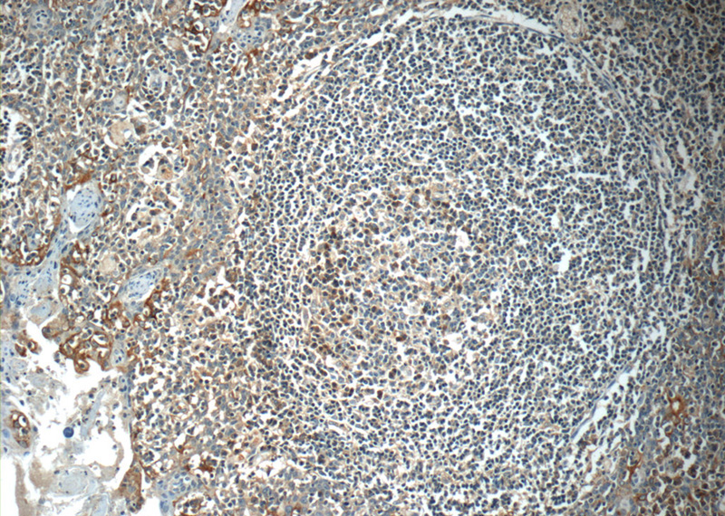 Immunohistochemistry of paraffin-embedded human tonsillitis tissue slide using Catalog No:110494(EVI2B Antibody) at dilution of 1:50 (under 10x lens)