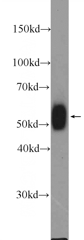 mouse thymus tissue were subjected to SDS PAGE followed by western blot with Catalog No:112171(LCK Antibody) at dilution of 1:1000