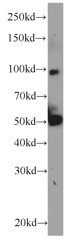 mouse liver tissue were subjected to SDS PAGE followed by western blot with Catalog No:107723(ACADVL antibody) at dilution of 1:500