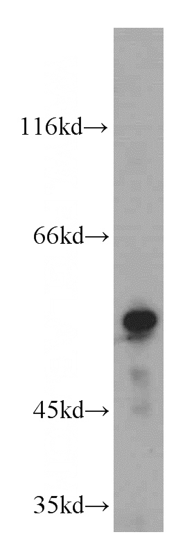 L02 cells were subjected to SDS PAGE followed by western blot with Catalog No:107975(ALDH8A1 antibody) at dilution of 1:500