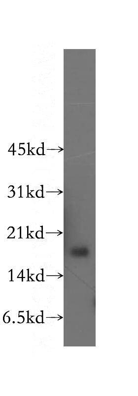 human heart tissue were subjected to SDS PAGE followed by western blot with Catalog No:108939(CBP20 antibody) at dilution of 1:500