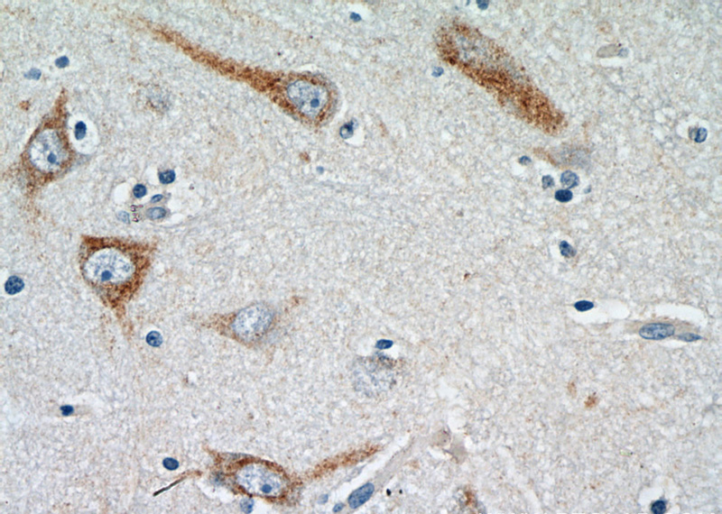 Immunohistochemistry of paraffin-embedded human brain tissue slide using Catalog No:111713(HTR6 Antibody) at dilution of 1:100 (under 40x lens).