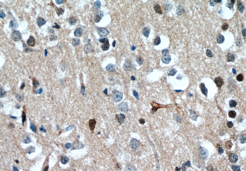 Immunohistochemistry of paraffin-embedded human brain tissue slide using Catalog No:116423(TSC22D1 Antibody) at dilution of 1:50 (under 40x lens)