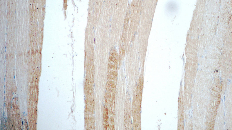 Immunohistochemistry of paraffin-embedded human skeletal muscle tissue slide using Catalog No:107771(ADAMTSL4 Antibody) at dilution of 1:50 (under 10x lens)