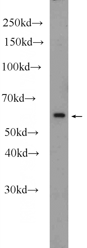 PC-3 cells were subjected to SDS PAGE followed by western blot with Catalog No:108731(C4orf29 Antibody) at dilution of 1:600