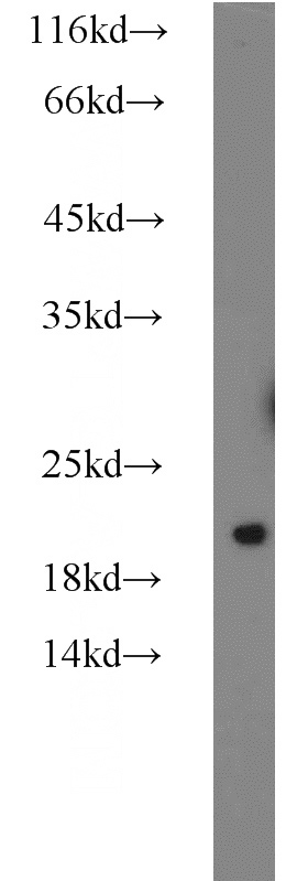 HeLa cells were subjected to SDS PAGE followed by western blot with Catalog No:112345(LSM1 antibody) at dilution of 1:600