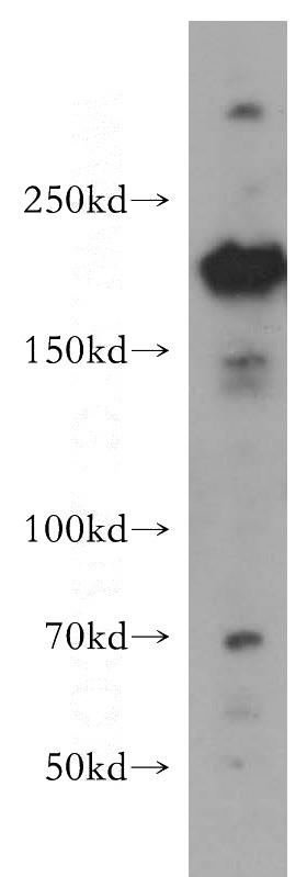 HeLa cells were subjected to SDS PAGE followed by western blot with Catalog No:116992(ERCC5 antibody) at dilution of 1:500