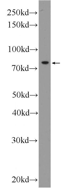 HeLa cells were subjected to SDS PAGE followed by western blot with Catalog No:112108(KLHL9 Antibody) at dilution of 1:300