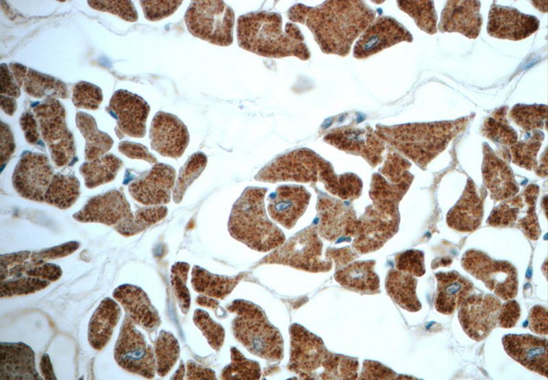 Immunohistochemistry of paraffin-embedded human heart slide using Catalog No:113624(PDK1 Antibody) at dilution of 1:50