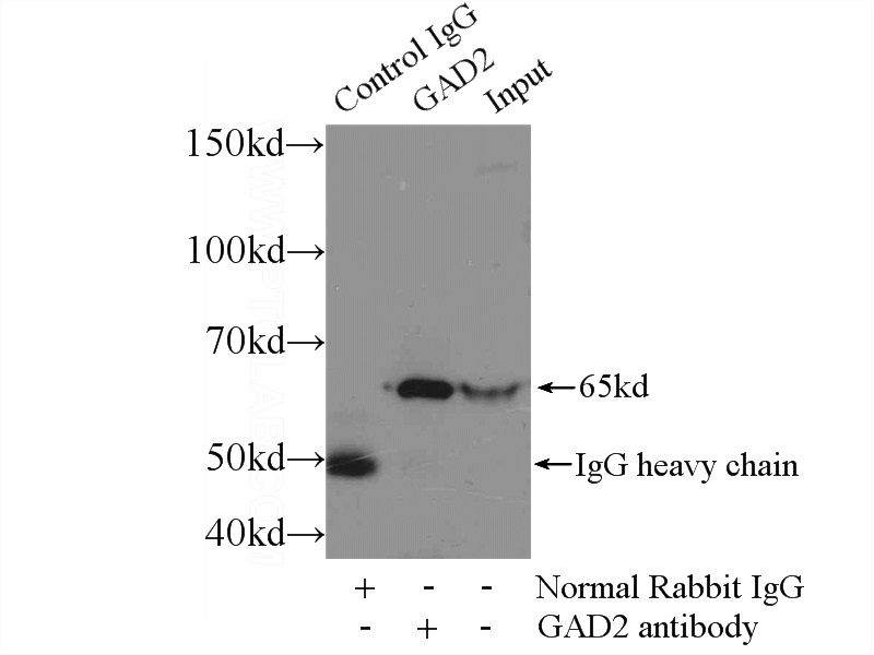 IP Result of anti-GAD2 (IP:Catalog No:110817, 3ug; Detection:Catalog No:110817 1:300) with rat brain tissue lysate 4000ug.