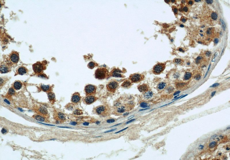 Immunohistochemical of paraffin-embedded human testis using Catalog No:109408(CLTCL1 antibody) at dilution of 1:50 (under 40x lens)