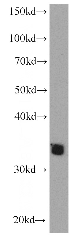 mouse lung tissue were subjected to SDS PAGE followed by western blot with Catalog No:107766(ADAM28 antibody) at dilution of 1:800