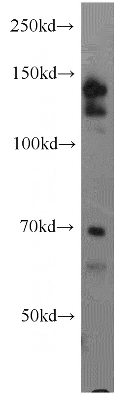MCF7 cells were subjected to SDS PAGE followed by western blot with Catalog No:115967(TACC1 antibody) at dilution of 1:1000