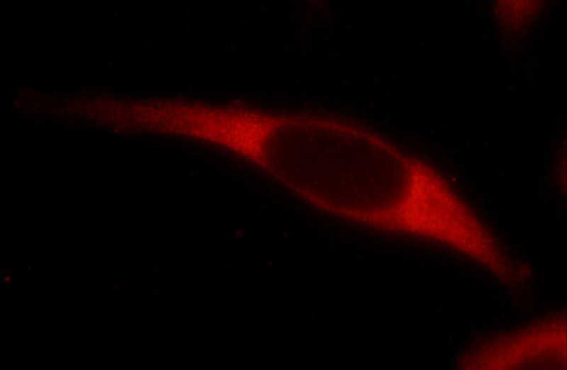 Immunofluorescent analysis of HeLa cells using Catalog No:116692(USP9X Antibody) at dilution of 1:25 and Rhodamine-Goat anti-Rabbit IgG