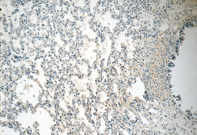Immunohistochemistry of paraffin-embedded human lung tissue slide using Catalog No:109376(COL2A1 Antibody) at dilution of 1:50 (under 10x lens)