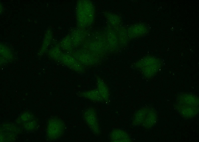 Immunofluorescent analysis of HepG2 cells using Catalog No:116937(ZCRB1 Antibody) at dilution of 1:50 and Alexa Fluor 488-congugated AffiniPure Goat Anti-Rabbit IgG(H+L)