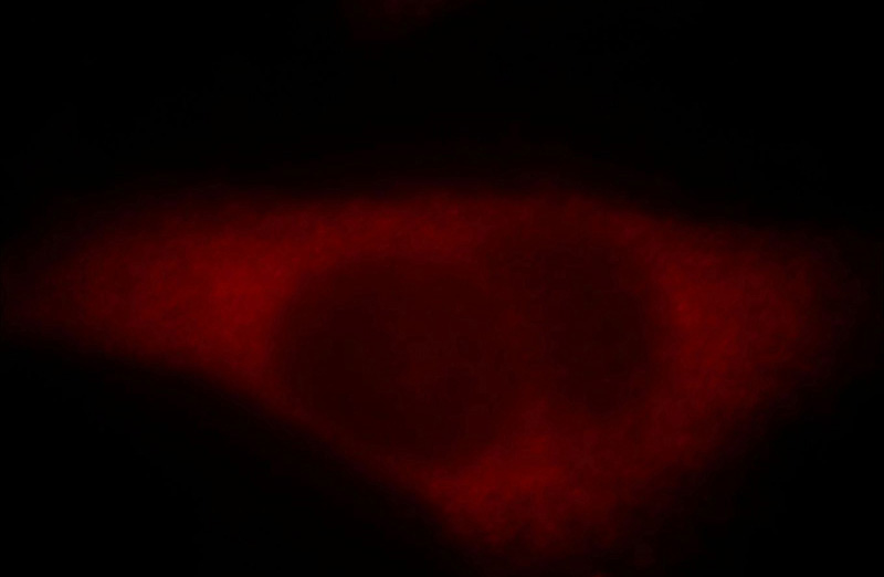 Immunofluorescent analysis of Hela cells, using PAK4 antibody Catalog No:113500 at 1:25 dilution and Rhodamine-labeled goat anti-rabbit IgG (red).