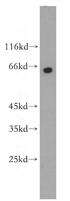 Raji cells were subjected to SDS PAGE followed by western blot with Catalog No:113569(PANK1 antibody) at dilution of 1:300