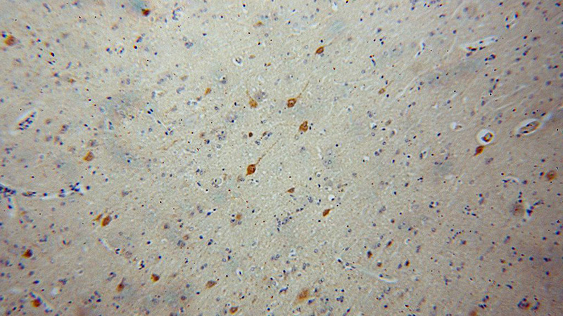 Immunohistochemical of paraffin-embedded human brain using Catalog No:114735(RNF10 antibody) at dilution of 1:100 (under 10x lens)